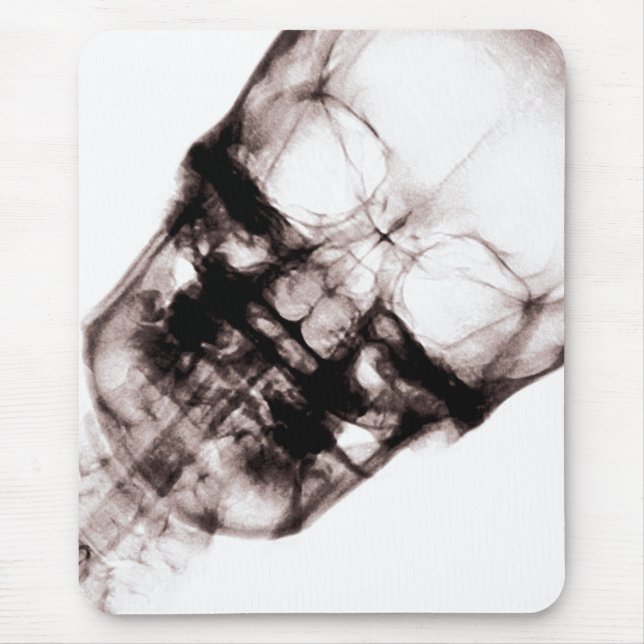 X-Ray Vision Skeleton Skull Face Mouse Pad (Front)