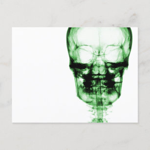 X-Ray Vision Skeleton Skull - Green Postcard