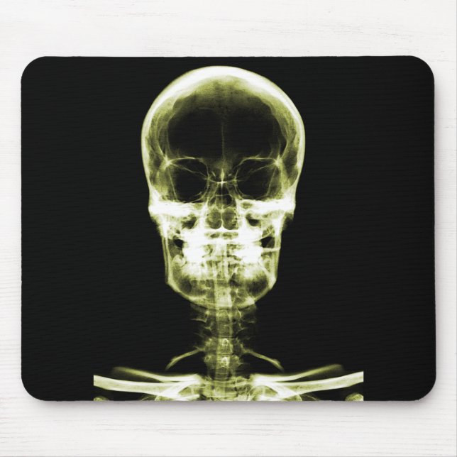 X-RAY VISION SKELETON SKULL - YELLOW MOUSE PAD (Front)
