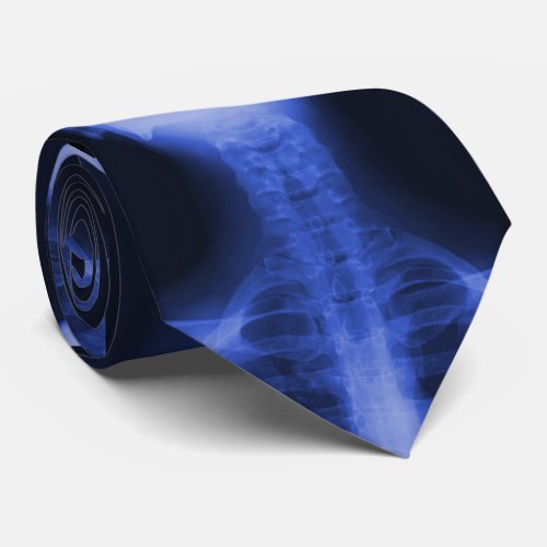 X_rayed 2 _ Electromagnetic Blue Tie
