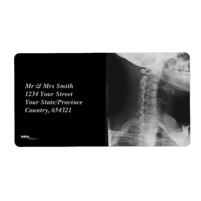 X-rayed 2 label (Front)