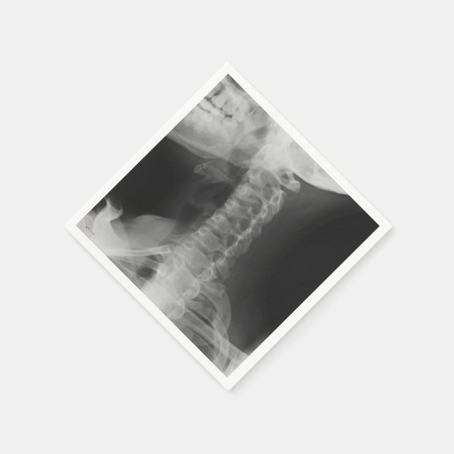 X-Rayed 2 (Original) Paper Napkins (Corner)