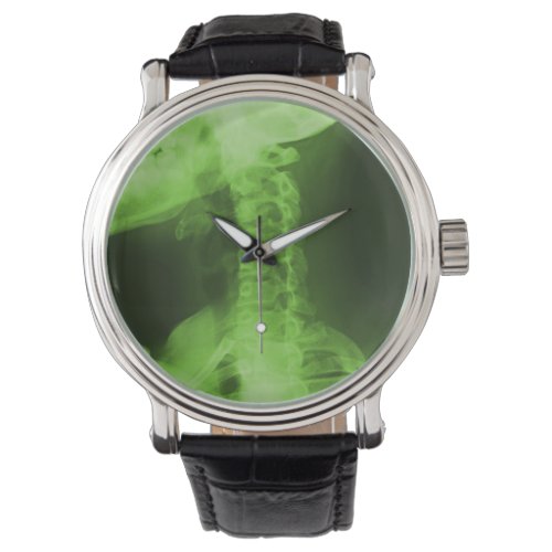 X_rayed 2 Radioactive Green Watch