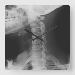 X-rayed 2 square wall clock