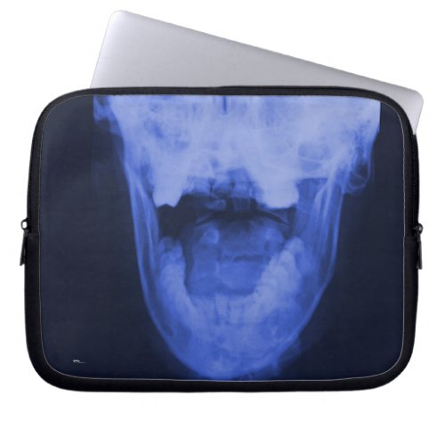 X_rayed 3 _ Electromagnetic Blue Laptop Sleeve