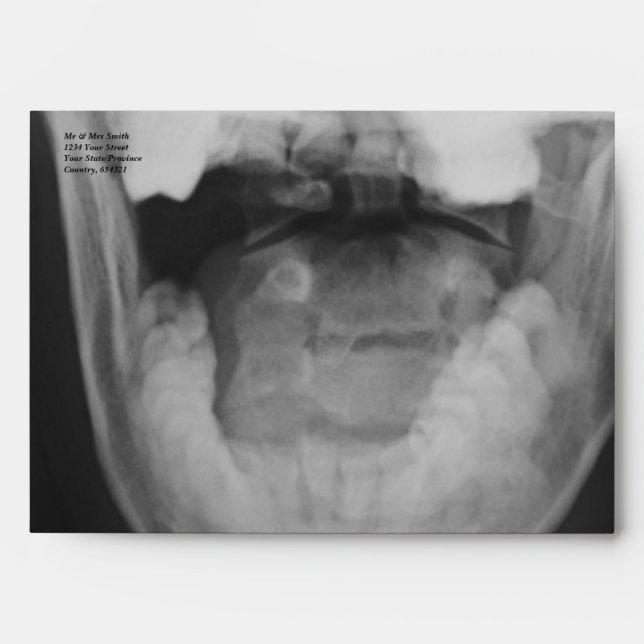 X-rayed 3 envelope (Front)