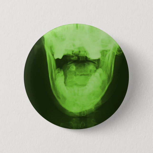 X-rayed 3 - Radioactive Green Button (Front)