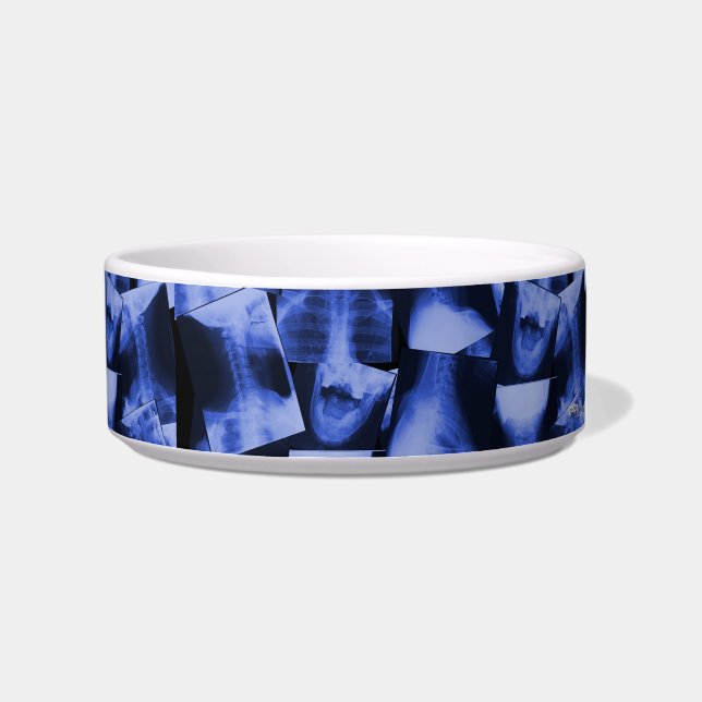 X-rayed - Electromagnetic Blue Bowl (Right)