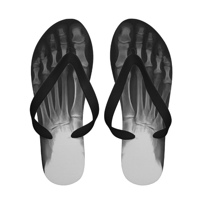 X rayed   Feet Flip Flops