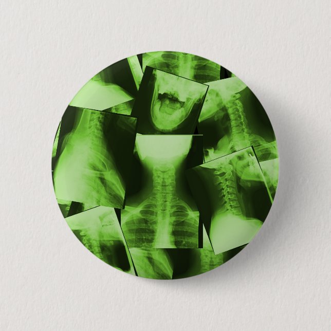 X-rayed - Radioactive Green Pinback Button (Front)