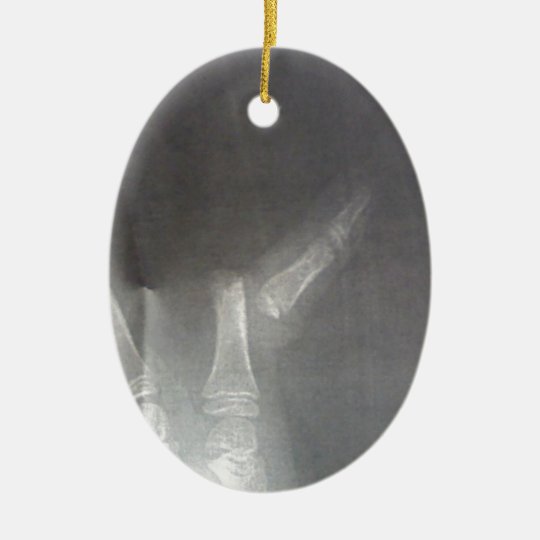 Xray Ceramic Ornament
