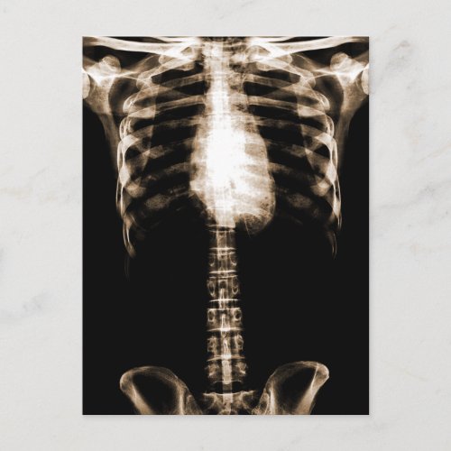 XRAY SKELETON TORSO RIBS SEPIA POSTCARD