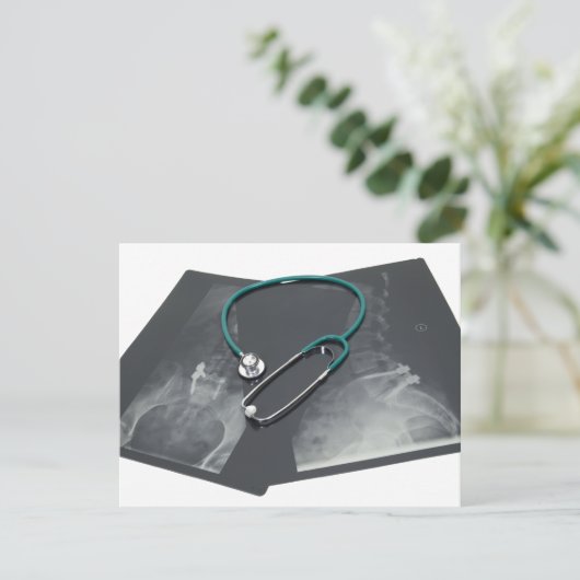 XRayConsult061209 (Standing Front)