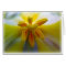 Yellow Tulip