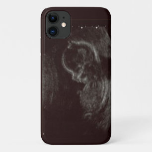 Your Babies Ultrasound Photo iPhone 11 Case